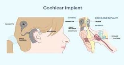 Communication Tools for Deaf